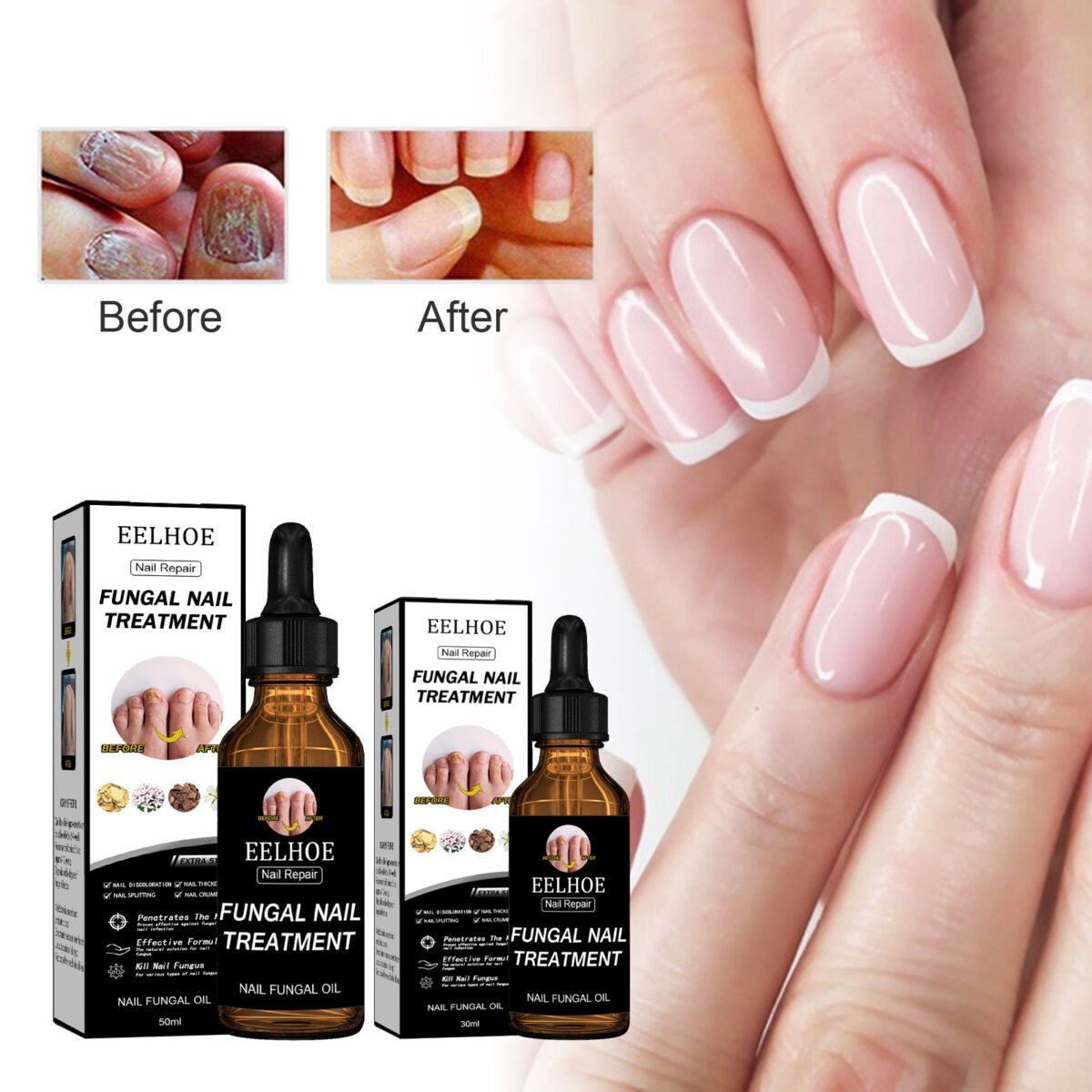 7a125268 41d3 4b29 9f1a b7bf87abfb14 EELHOE Nail Repair Solution, Thickening And Brightening Nails Removing Gray Nail Repair Nourishing Nail Care Solution